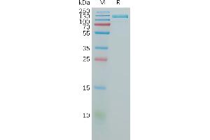 Human CD106 Protein, hFc Tag on SDS-PAGE under reducing condition. (VCAM1 Protein (AA 25-698) (Fc Tag))