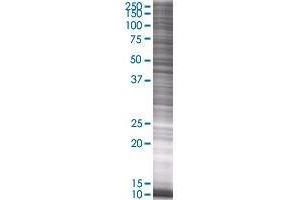 LEFTY2 transfected lysate. (LEFTY2 293T Cell Transient Overexpression Lysate(Denatured))