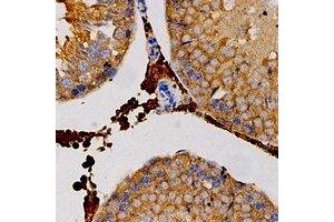 Immunohistochemical analysis of Carbonic Anhydrase 3 staining in human testis formalin fixed paraffin embedded tissue section. (CA3 抗体)