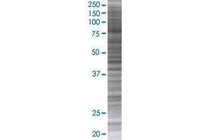 Western Blotting (WB) image for HKR3 293T Cell Transient Overexpression Lysate(Denatured) (ABIN1332123)