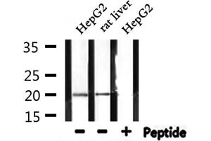 Western blot analysis of extracts from HepG2 and rat liver, using RPL27A Antibody. (RPL27A 抗体  (C-Term))