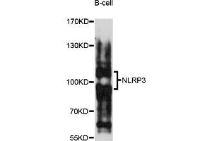 Western blot analysis of extracts of B-cell cells, using NLRP3 antibody (ABIN5973297) at 1/1000 dilution. (NLRP3 抗体)