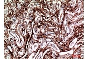 Immunohistochemical analysis of paraffin-embedded human-kidney, antibody was diluted at 1:100. (M-CSF/CSF1 抗体  (C-Term))