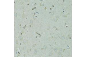 Immunohistochemistry of paraffin-embedded rat brain using GTF2H2C antibody (ABIN1876445) at dilution of 1:100 (40x lens). (GTF2H2C 抗体)