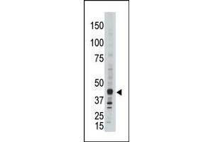 Western Blotting (WB) image for anti-Apolipoprotein B mRNA Editing Enzyme, Catalytic Polypeptide-Like 3G (APOBEC3G) (C-Term) antibody (ABIN356860) (APOBEC3G 抗体  (C-Term))