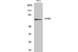 Western Blot analysis of various cells using AR-β2 Polyclonal Antibody diluted at 1:2000. (Androgen Receptor beta 2 抗体  (AA 180-260))