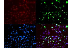Immunofluorescence analysis of GFP-RNF168 trangenic U2OS cell using MSH6 antibody. (MSH6 抗体)