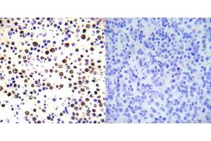 Immunohistochemical analysis of paraffin-embedded human malignant lymphoma tissue using Histone H3. (Histone H3.1 抗体  (pThr3))