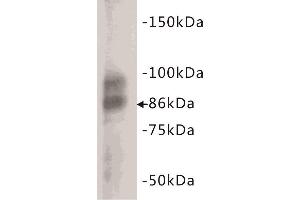 Western Blotting (WB) image for anti-Glycoprotein Hormones, alpha Polypeptide (CGA) (C-Term) antibody (ABIN1854868) (CGA 抗体  (C-Term))