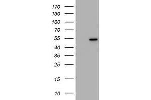 Image no. 1 for anti-Vimentin (VIM) antibody (ABIN1501719) (Vimentin 抗体)