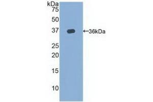 Detection of Recombinant TERT, Rat using Polyclonal Antibody to Telomerase Reverse Transcriptase (TERT) (TERT 抗体  (AA 673-976))