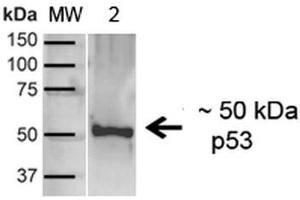 Western blot analysis of Human A431 showing detection of ~43. (p53 抗体  (C-Term) (HRP))
