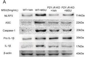 Western Blotting (WB) image for anti-Steroid Sulfatase (STS) antibody (ABIN2170333)