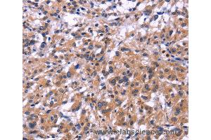 Immunohistochemistry of Human brain  using SIGLEC5 Polyclonal Antibody at dilution of 1:30 (SIGLEC5 抗体)