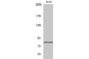 Western Blotting (WB) image for anti-Lipase, Hormone-Sensitive (LIPE) (Ser774) antibody (ABIN3175557) (LIPE 抗体  (Ser774))