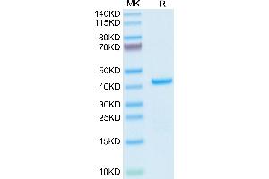 Human EMAP-II on Tris-Bis PAGE under reduced condition. (AIMP1 Protein (AA 2-312) (His tag))