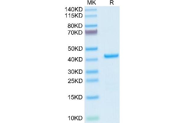 AIMP1 Protein (AA 2-312) (His tag)