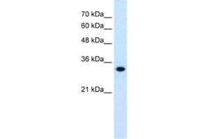 Western Blotting (WB) image for anti-3-Hydroxymethyl-3-Methylglutaryl-CoA Lyase (HMGCL) antibody (ABIN2462455) (HMGCL 抗体)