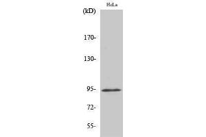 Western Blotting (WB) image for anti-Signal Transducer and Activator of Transcription 6, Interleukin-4 Induced (STAT6) (pTyr641) antibody (ABIN3179510) (STAT6 抗体  (pTyr641))
