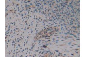 IHC-P analysis of Rat Uterus Tissue, with DAB staining. (AMH 抗体  (AA 447-553))