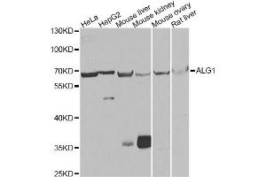 Western blot analysis of extracts of various cell lines, using ALG1 antibody (ABIN5975731) at 1/1000 dilution. (ALG1 抗体)