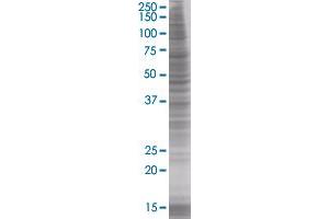 CFHR1 transfected lysate (CFHR1 293T Cell Transient Overexpression Lysate(Denatured))