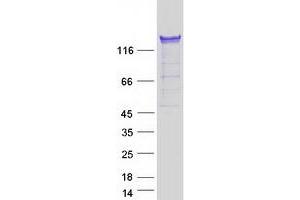 Validation with Western Blot (PUM1 Protein (Transcript Variant 2) (Myc-DYKDDDDK Tag))