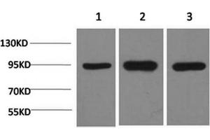Western Blotting (WB) image for anti-Heat Shock Protein 90kDa alpha (Cytosolic), Class A Member 2 (HSP90AA2) antibody (ABIN5961311) (HSP90AA2 抗体)