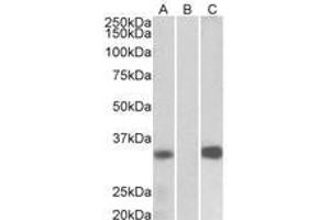 Image no. 1 for anti-Kv Channel Interacting Protein 3, Calsenilin (KCNIP3) (AA 21-31) antibody (ABIN1102701) (DREAM 抗体  (AA 21-31))