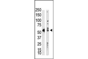 Western Blotting (WB) image for anti-tRNA Aspartic Acid Methyltransferase 1 (TRDMT1) (AA 300-400) antibody (ABIN356546) (Dnmt2 抗体  (AA 300-400))