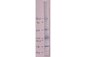 Immunoblot using anti-RSV-Hyperimmune Serum (Marker: Amidoblack) (Respiratory Syncytial Virus Long Strain (RSV Long) 抗体)