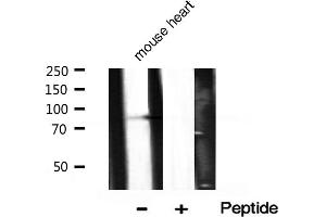 Western blot analysis of Phospho-PI3K p85 alpha (Tyr607) expression in Mouse heart tissue lysate (PIK3R1 抗体  (pTyr607))