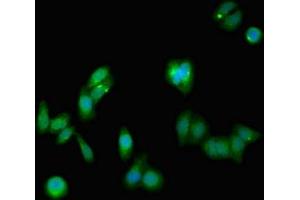 Immunofluorescent analysis of HepG2 cells using ABIN7161294 at dilution of 1:100 and Alexa Fluor 488-congugated AffiniPure Goat Anti-Rabbit IgG(H+L) (Notch1 抗体  (AA 2428-2555))