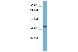 WB Suggested Anti-ATG3 Antibody Titration: 0. (ATG3 抗体  (Middle Region))