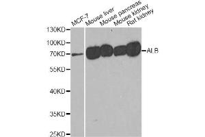 Western blot analysis of extracts of various cell lines, using ALB antibody (ABIN5970637) at 1/500 dilution. (Albumin 抗体)