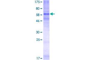 Image no. 1 for Chemokine (C-C Motif) Receptor 3 (CCR3) (AA 1-355) protein (GST tag) (ABIN1348497) (CCR3 Protein (AA 1-355) (GST tag))