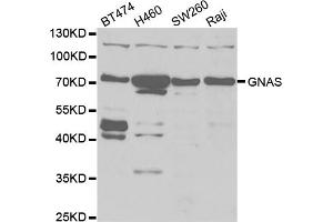 Western blot analysis of extracts of various cell lines, using GNAS antibody. (GNAS 抗体)