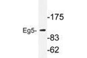 Western blot analysis of Eg5 antibody in extracts from COLO205 cells. (KIF11 抗体)