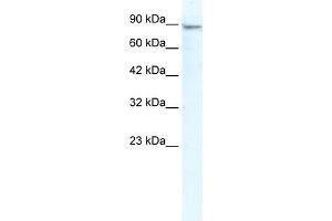 WB Suggested Anti-MCM4 Antibody Titration:  2. (MCM4 抗体  (N-Term))