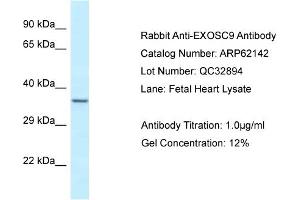 Western Blotting (WB) image for anti-Exosome Component 9 (EXOSC9) (N-Term) antibody (ABIN970651) (EXOSC9 抗体  (N-Term))