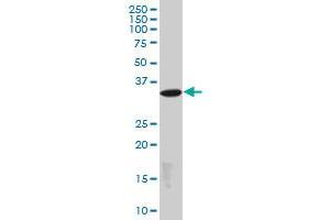 EPM2A monoclonal antibody (M01), clone 4A12. (EPM2A 抗体  (AA 101-199))