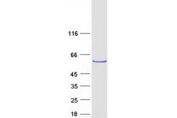 LRRC6 Protein (Myc-DYKDDDDK Tag)