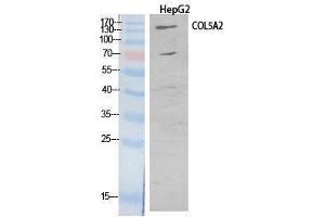 Western Blotting (WB) image for anti-Collagen, Type V, alpha 2 (COL5A2) (Internal Region) antibody (ABIN6287447) (COL5A2 抗体  (Internal Region))