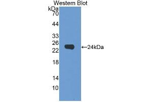 Western blot analysis of the recombinant protein. (Dermokine 抗体  (AA 27-238))