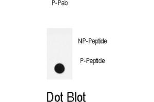 Dot Blot (DB) image for anti-LPR1 (pSer4520) antibody (ABIN3001761) (LPR1 (pSer4520) 抗体)