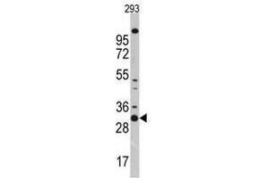 Image no. 1 for anti-Cyclin-Dependent Kinase 1 (CDK1) (N-Term) antibody (ABIN357035) (CDK1 抗体  (N-Term))