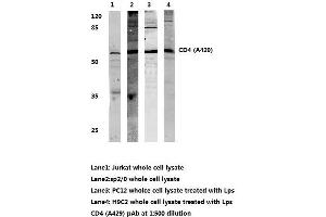 Western blot analysis of CD4 (pAla429) (CD4 抗体)