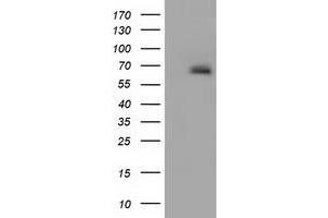 Western Blotting (WB) image for anti-alpha-Fetoprotein (AFP) antibody (ABIN1496486) (alpha Fetoprotein 抗体)