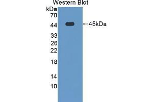 Detection of Recombinant CRY1, Human using Polyclonal Antibody to Cryptochrome 1 (CRY1) (CRY1 抗体  (AA 3-132))