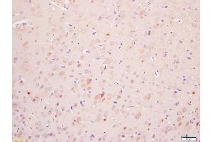 Formalin-fixed and paraffin embedded rat brain labeled with Anti-Phospho-MAPKAPK2(Ser272)Polyclonal Antibody, Unconjugated (ABIN710531) at 1:200, followed by conjugation to the secondary antibody and DAB staining (MAPKAP Kinase 2 抗体  (pSer272))